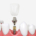 implant diş tedavi, implant diş tedavi nedir?, implant diş tedavi fiyatları,